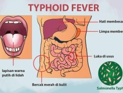 Tipes, Penyakit Berbahaya Banyak Diidap Pasien RS Datu Beru Takengon